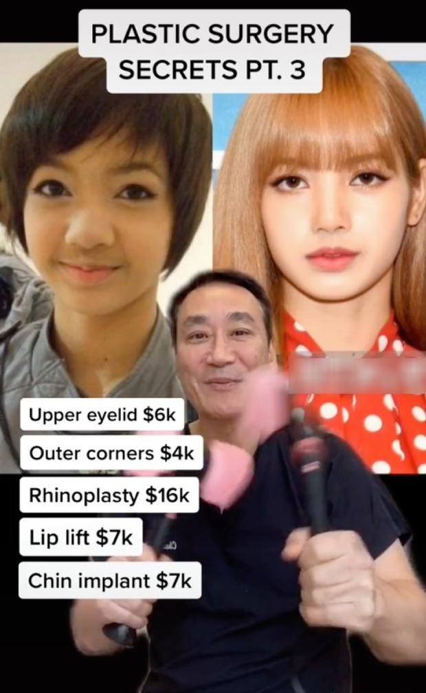 HÓNG: Bác sĩ khẳng định cả 4 thành viên BLACKPINK dao kéo, riêng Lisa sửa mặt hết gần 1 tỷ VNĐ? - Ảnh 2.