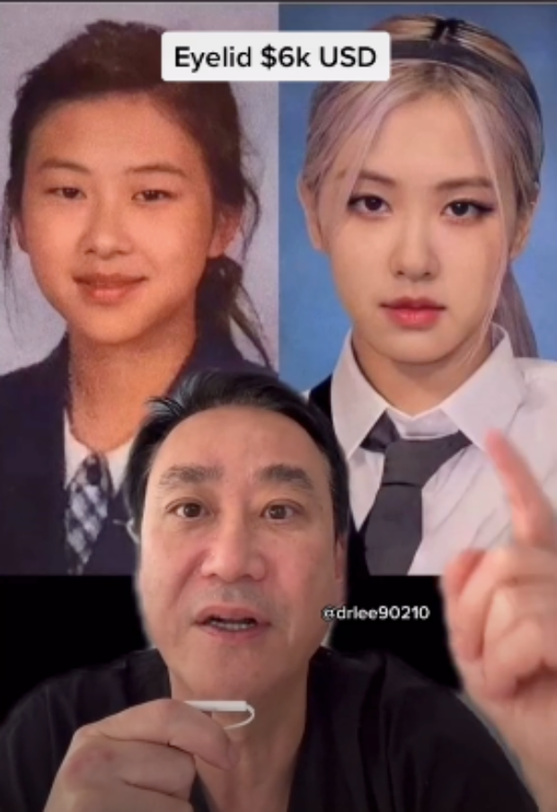 Loạt ảnh này là nguồn cơn cả 4 mỹ nhân BLACKPINK bị tố dao kéo: Mắt của Rosé khác hẳn, mũi Lisa - Jisoo biến hóa ảo diệu? - Ảnh 12. Loạt ảnh này là nguồn cơn cả 4 mỹ nhân BLACKPINK bị tố dao kéo: Mắt của Rosé khác hẳn, mũi Lisa - Jisoo biến hóa ảo diệu? - Ảnh 12.