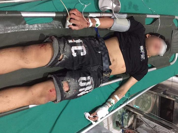 Tai nạn giao thông nghiêm trọng, 3 học sinh tử vong, 1 học sinh bị thương nặng - Ảnh 2.