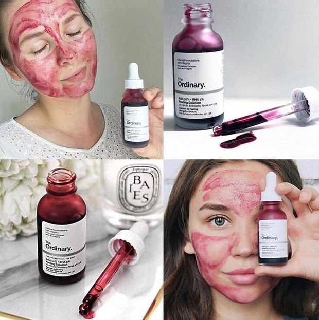 Banh mặt chỉ vì thiếu kiến thức peel da, dân tình xót xa khi thấy làn da bỏng rộp đau đớn của cô gái này - Ảnh 2. Banh mặt chỉ vì thiếu kiến thức peel da, dân tình xót xa khi thấy làn da bỏng rộp đau đớn của cô gái này - Ảnh 2.