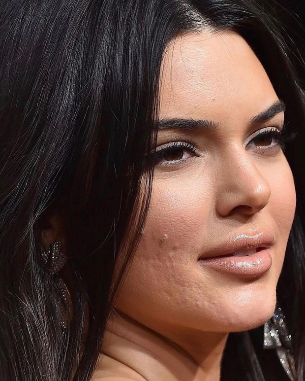 Hung thần ảnh cận mặt tố visual thật dàn sao: Làn da nhăn của Kim Kardashian chưa gây hoảng bằng cô em Kendall Jenner! - Ảnh 3.