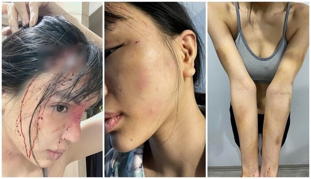 NÓNG: Siêu mẫu Khả Trang công bố quá trình được mẹ đẻ và công an giải cứu sau 2 ngày bị giam lỏng hành hung - Ảnh 5.