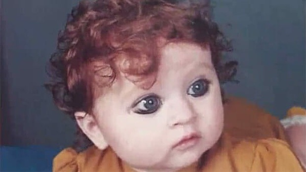 Sinh ra bị cả làng xa lánh, chế giễu là “quái vật” vì ngoại hình khác lạ, hơn 20 năm sau cô gái khiến ai nấy sững sờ vì nhan sắc hiện tại - Ảnh 1. Sinh ra bị cả làng xa lánh, chế giễu là “quái vật” vì ngoại hình khác lạ, hơn 20 năm sau cô gái khiến ai nấy sững sờ vì nhan sắc hiện tại - Ảnh 1.
