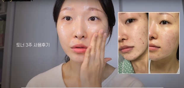 Makeup artist người Hàn chia sẻ loạt sản phẩm đỉnh cao giúp cô “cải tạo” làn da thâm mụn xấu xí trở nên căng mướt như phủ sương - Ảnh 7. Makeup artist người Hàn chia sẻ loạt sản phẩm đỉnh cao giúp cô “cải tạo” làn da thâm mụn xấu xí trở nên căng mướt như phủ sương - Ảnh 7.