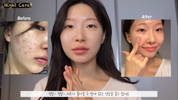 Makeup artist người Hàn chia sẻ loạt sản phẩm đỉnh cao giúp cô “cải tạo” làn da thâm mụn xấu xí trở nên căng mướt như phủ sương - Ảnh 1. Makeup artist người Hàn chia sẻ loạt sản phẩm đỉnh cao giúp cô “cải tạo” làn da thâm mụn xấu xí trở nên căng mướt như phủ sương - Ảnh 1.