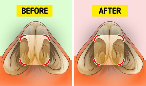 Khi hành động cực quen thuộc trở thành... tự hoại: Đây là 6 lý do để bạn làm gì thì làm, đừng nên ngoáy mũi - Ảnh 6.