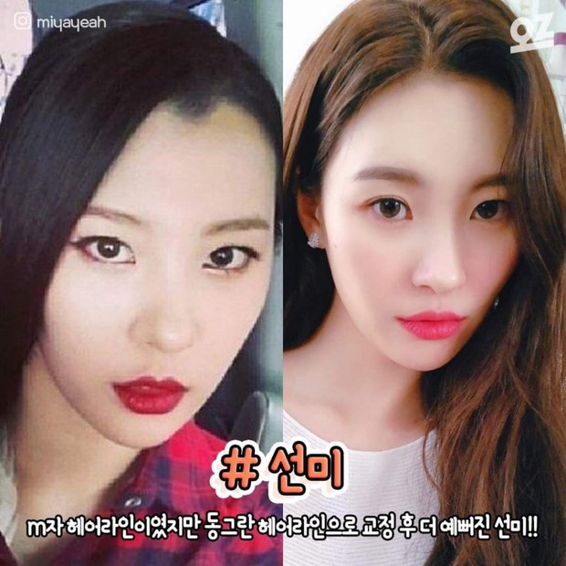 4 idol nhan sắc “lên hương” nhờ thay đổi đường chân tóc: Yoona, Suzy như nữ thần nhưng màn lột xác của Sunmi mới đỉnh - Ảnh 9.