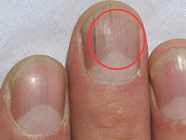 3 bộ phận trên cơ thể chuyển dần sang màu thâm đen chứng tỏ gan đang có vấn đề - Ảnh 2. 3 bộ phận trên cơ thể chuyển dần sang màu thâm đen chứng tỏ gan đang có vấn đề - Ảnh 2.
