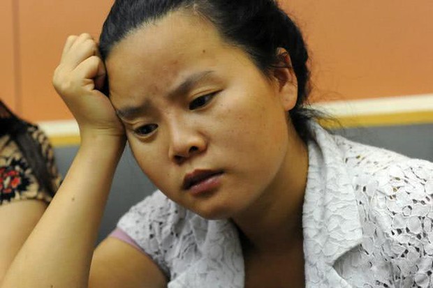 3 bộ phận trên cơ thể chuyển dần sang màu thâm đen chứng tỏ gan đang có vấn đề - Ảnh 1. 3 bộ phận trên cơ thể chuyển dần sang màu thâm đen chứng tỏ gan đang có vấn đề - Ảnh 1.