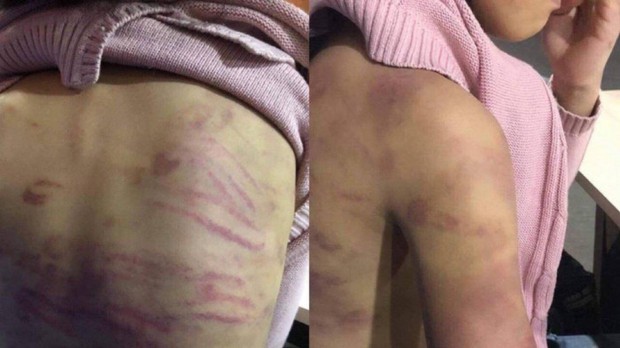 Khởi tố bị can vụ cháu bé 12 tuổi bị mẹ bạo hành, người tình của mẹ cưỡng bức - Ảnh 1. Khởi tố bị can vụ cháu bé 12 tuổi bị mẹ bạo hành, người tình của mẹ cưỡng bức - Ảnh 1.
