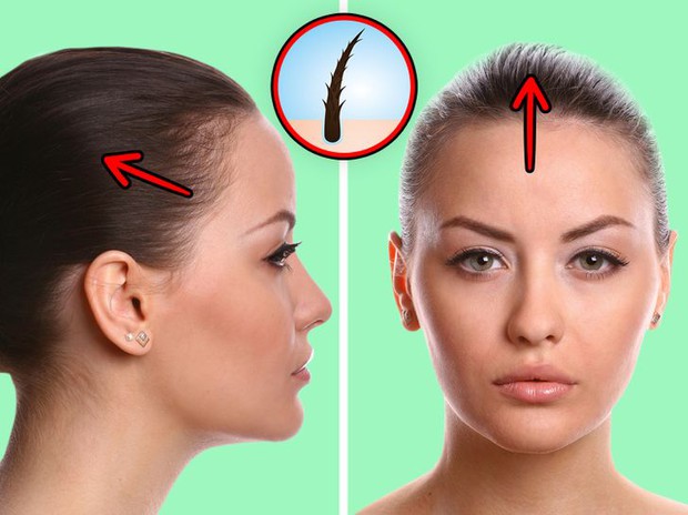6 vấn đề sức khỏe mà con gái phải đối mặt nếu duy trì thói quen buộc tóc đuôi ngựa thường xuyên - Ảnh 2.