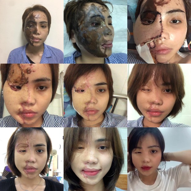 Cô gái bị chồng sắp cưới tạt axit xuất hiện với tạo hình mới lạ trong bộ ảnh đậm chất nghệ thuật - Ảnh 1. Cô gái bị chồng sắp cưới tạt axit xuất hiện với tạo hình mới lạ trong bộ ảnh đậm chất nghệ thuật - Ảnh 1.