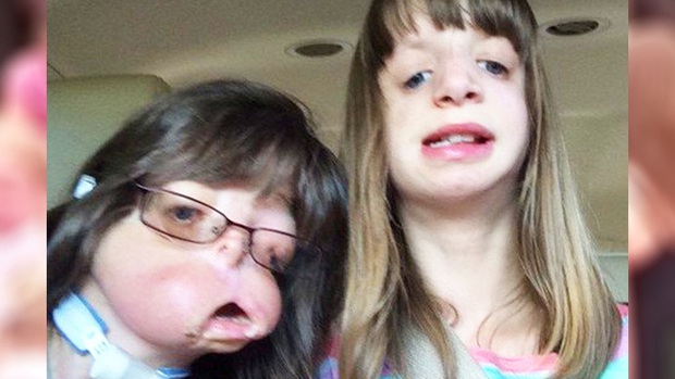 Bé gái sinh ra “không có mặt” khiến cả thế giới ngỡ ngàng gây bất ngờ với diện mạo và cuộc sống sau nhiều năm - Ảnh 7.