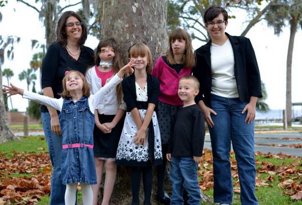 Bé gái sinh ra “không có mặt” khiến cả thế giới ngỡ ngàng gây bất ngờ với diện mạo và cuộc sống sau nhiều năm - Ảnh 8.