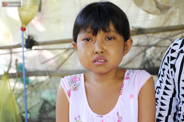 Nước mắt người mẹ có con gái bị teo gan, lá lách to đang chết mòn vì gia cảnh cùng cực: Chỉ sợ nó bỏ mình mà đi - Ảnh 8.