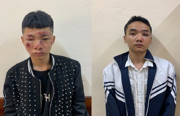 Một CSGT bị 2 thanh niên 17 tuổi phóng xe máy tông gãy xương chân tay, xương gò má - Ảnh 1.