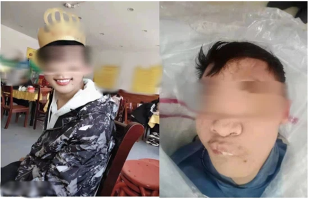 Nam sinh tử vong biến dạng cả khuôn mặt, người mẹ khóc ngất khi biết được sự thật đằng sau lớp vỏ hào nhoáng của nhà trường - Ảnh 1. Nam sinh tử vong biến dạng cả khuôn mặt, người mẹ khóc ngất khi biết được sự thật đằng sau lớp vỏ hào nhoáng của nhà trường - Ảnh 1.