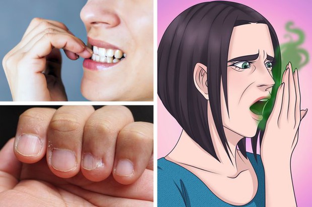 5 vấn đề sức khỏe sẽ xảy ra nếu bạn thường xuyên cắn móng tay, sửa ngay trước khi quá muộn - Ảnh 2. 5 vấn đề sức khỏe sẽ xảy ra nếu bạn thường xuyên cắn móng tay, sửa ngay trước khi quá muộn - Ảnh 2.