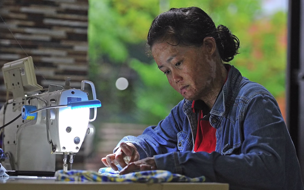 Nỗi đau dai dẳng của người vợ bị chồng tẩm xăng thiêu sống, dùng hết sức lực để cứu hai con - Ảnh 4. Nỗi đau dai dẳng của người vợ bị chồng tẩm xăng thiêu sống, dùng hết sức lực để cứu hai con - Ảnh 4.