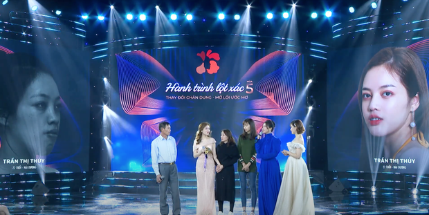 Màn lột xác xuất sắc: Cô gái với chiếc lưỡi khổng lồ bỗng “vịt hoá thiên nga nhờ dao kéo - Ảnh 8.