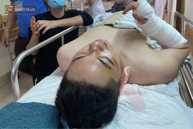 Nạn nhân kể lại giây phút bị rơi xuống tầng 1 do trần chung cư thủng: Tôi và nữ Giám đốc đang bê thùng các tông đặt vào góc thì nền bị sập, sau đó tôi bất tỉnh - Ảnh 3. Nạn nhân kể lại giây phút bị rơi xuống tầng 1 do trần chung cư thủng: Tôi và nữ Giám đốc đang bê thùng các tông đặt vào góc thì nền bị sập, sau đó tôi bất tỉnh - Ảnh 3.