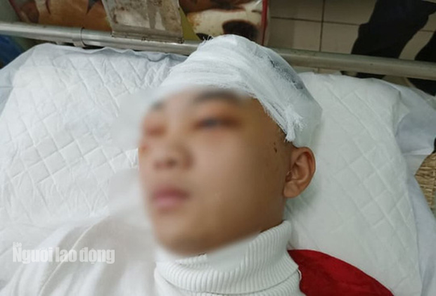 Nam sinh lớp 11 bị bạn đánh vỡ sọ não tổn hại sức khỏe tới 49% - Ảnh 1.