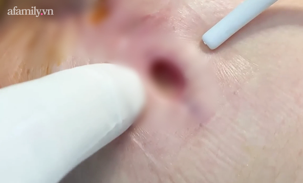 Người phụ nữ bị spa bỏ quên miếng gạc trong ngực nói dối chồng vào Sài Gòn chữa bệnh để đi làm đẹp, hết 53 triệu, cho chủ spa vay 150 triệu? - Ảnh 5.