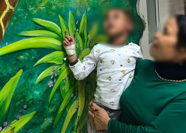 Bé trai hơn 4 tuổi bị chó nhà cắn tổn thương nặng vùng đầu - Ảnh 2.