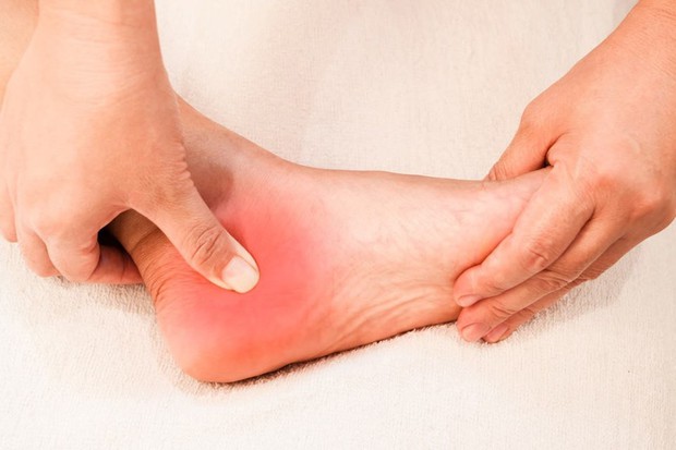 4 tình trạng xảy ra ở bàn chân ngầm cảnh báo nhiều vấn đề sức khỏe nghiêm trọng mà bạn không nên chủ quan - Ảnh 2. 4 tình trạng xảy ra ở bàn chân ngầm cảnh báo nhiều vấn đề sức khỏe nghiêm trọng mà bạn không nên chủ quan - Ảnh 2.