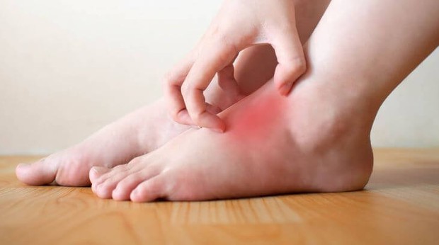 4 tình trạng xảy ra ở bàn chân ngầm cảnh báo nhiều vấn đề sức khỏe nghiêm trọng mà bạn không nên chủ quan - Ảnh 3. 4 tình trạng xảy ra ở bàn chân ngầm cảnh báo nhiều vấn đề sức khỏe nghiêm trọng mà bạn không nên chủ quan - Ảnh 3.
