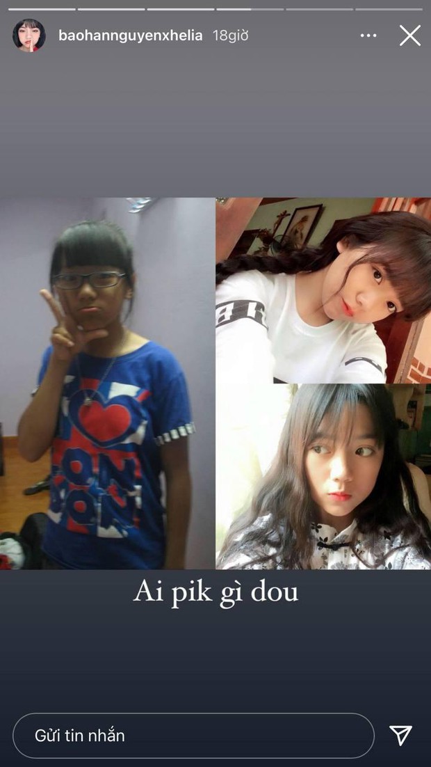 Hot teen 2k tự tung ảnh thời da đen mắt cận, netizen ngỡ ngàng vì nhan sắc khác “một trời một vực” - Ảnh 1. Hot teen 2k tự tung ảnh thời da đen mắt cận, netizen ngỡ ngàng vì nhan sắc khác “một trời một vực” - Ảnh 1.