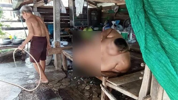 Bi kịch của cậu bé béo nhất Thái Lan: 13 tuổi đã nặng 200kg, từ bé bị ép ăn cho “chóng lớn” và hậu quả đáng thương gây ám ảnh - Ảnh 2.