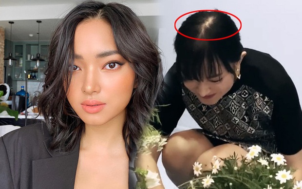 Chuyện hói đầu không của riêng ai: Đại diện Việt Nam có Phạm Hương, Châu Bùi nhưng sốc nhất phải là sao Hoa ngữ - Ảnh 2. Chuyện hói đầu không của riêng ai: Đại diện Việt Nam có Phạm Hương, Châu Bùi nhưng sốc nhất phải là sao Hoa ngữ - Ảnh 2.