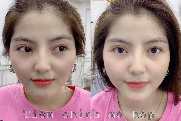 Xôn xao ảnh bạn gái tin đồn của Quang Hải đi chỉnh sửa nhan sắc, gương mặt before gây chú ý - Ảnh 3. Xôn xao ảnh bạn gái tin đồn của Quang Hải đi chỉnh sửa nhan sắc, gương mặt before gây chú ý - Ảnh 3.