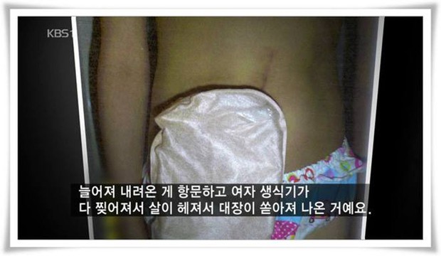 Kỳ án ấu dâm rúng động Hàn Quốc tiếp tục được tái hiện ở Mouse của Lee Seung Gi: Kết buồn cho nạn nhân vì kẽ hở pháp luật - Ảnh 1.