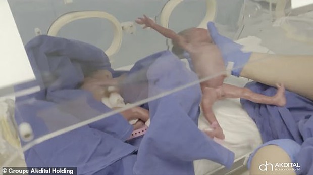 Hình ảnh mới nhất của các em bé trong ca sinh 9 hy hữu gây chấn động thế giới gần đây - Ảnh 7.