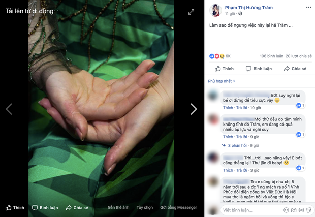 Fan xót xa khoảnh khắc Hương Tràm biểu diễn cười tươi nhưng tay rỉ máu vì chứng stress kéo dài - Ảnh 4.