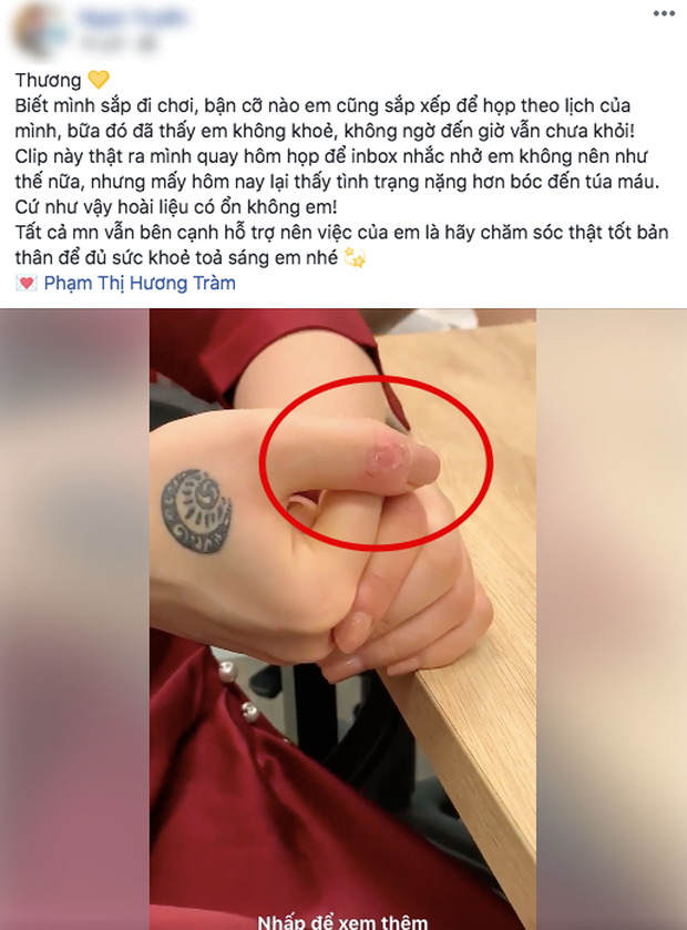 Fan xót xa khoảnh khắc Hương Tràm biểu diễn cười tươi nhưng tay rỉ máu vì chứng stress kéo dài - Ảnh 5.