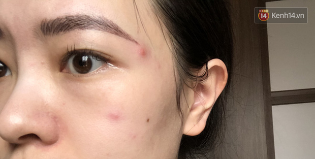 Chăm chỉ uống viêm nang gấc và collagen, da mình ngày càng bóng khoẻ, ra đường không makeup vẫn rất tự tin - Ảnh 1. Chăm chỉ uống viêm nang gấc và collagen, da mình ngày càng bóng khoẻ, ra đường không makeup vẫn rất tự tin - Ảnh 1.
