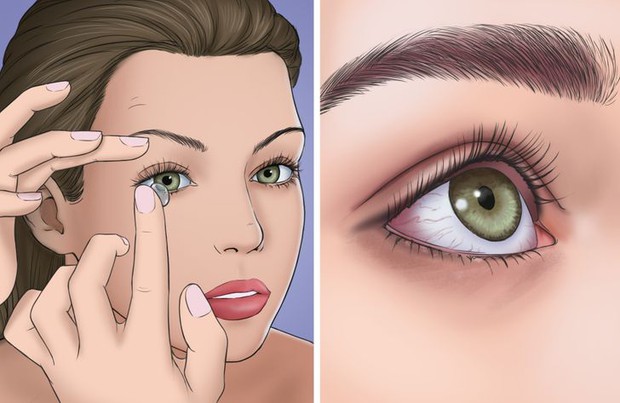 10 vật dụng trong nhà nên vứt bỏ ngay cả khi còn mới kẻo rước bệnh vào người - Ảnh 1.