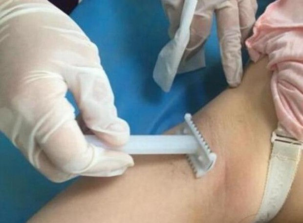 3 nguyên nhân khiến chị em bị... lắm lông, cần cảnh giác với điều đầu tiên - Ảnh 4. 3 nguyên nhân khiến chị em bị... lắm lông, cần cảnh giác với điều đầu tiên - Ảnh 4.