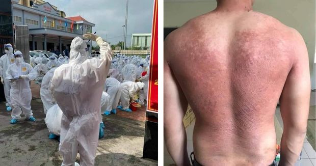 Nếu bạn đang thấy nóng phát điên, hãy nhìn hình ảnh những chiến sĩ áo trắng nơi tâm dịch đang trùm đồ bảo hộ kín mít này! - Ảnh 2.