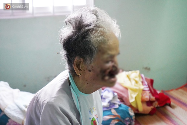 Ngày cuối đời của bà cụ bị ung thư xương hàm, lở loét khắp miệng: Bà chỉ mong chết sớm để con cháu bớt khổ - Ảnh 4.
