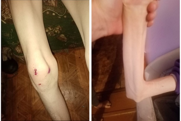 Tin tưởng gửi con gái ở trường nội trú, 1 năm sau cặp vợ chồng chết điếng nhìn thấy con như xác sống - Ảnh 2.