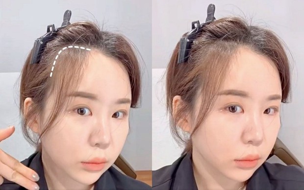 Đừng đi vào vết xe đổ của sao, hãy học ngay cách tự cắt tóc để không lộ hói đầu bạn ơi - Ảnh 4. Đừng đi vào vết xe đổ của sao, hãy học ngay cách tự cắt tóc để không lộ hói đầu bạn ơi - Ảnh 4.