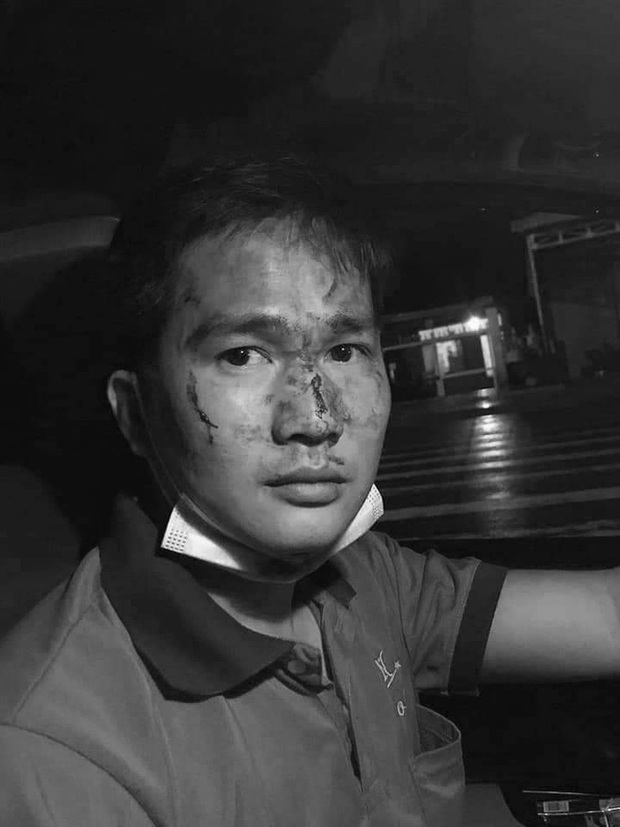 Thanh niên đánh tài xế taxi đổ máu ở Bình Phước đã đưa vợ, con rời khỏi nơi tạm trú - Ảnh 2. Thanh niên đánh tài xế taxi đổ máu ở Bình Phước đã đưa vợ, con rời khỏi nơi tạm trú - Ảnh 2.