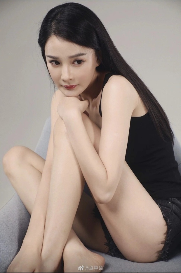 Cô gái bị kiện vì “tội” trông quá giống Phạm Băng Băng, rơi vào cảnh thất nghiệp, lao đao đến mức phải phẫu thuật cho bớt giống - Ảnh 5. Cô gái bị kiện vì “tội” trông quá giống Phạm Băng Băng, rơi vào cảnh thất nghiệp, lao đao đến mức phải phẫu thuật cho bớt giống - Ảnh 5.