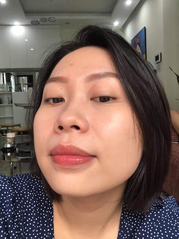 Da vừa khô vừa mụn vì không chăm sóc kĩ mỗi khi đi du lịch, cô nàng tốn 7 tháng để lấy lại làn da mịn màng với quy trình skincare 5 bước - Ảnh 12. Da vừa khô vừa mụn vì không chăm sóc kĩ mỗi khi đi du lịch, cô nàng tốn 7 tháng để lấy lại làn da mịn màng với quy trình skincare 5 bước - Ảnh 12.