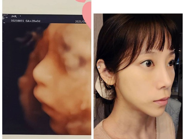 Top 1 Naver: Đăng ảnh con trai mới sinh cằm nhọn bất thường, nữ idol gen 1 bị nghi bóp ảnh, sống ảo quá đà - Ảnh 8.