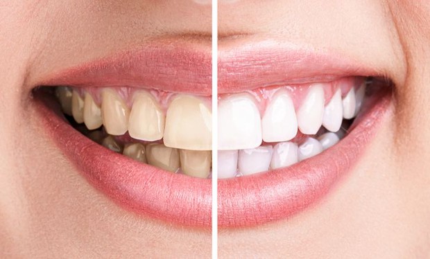 7 quan niệm về cơ thể ai cũng nghĩ là đúng, nhưng thực ra là sai quá sai - Ảnh 6. 7 quan niệm về cơ thể ai cũng nghĩ là đúng, nhưng thực ra là sai quá sai - Ảnh 6.